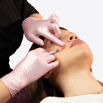 Surcos y fosa piramidal (1ml acido hialuronico)